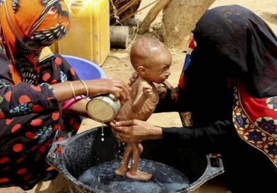 الفقر في اليمن.. سرطان الحوثي الذي ينهش في أجساد الضعفاء