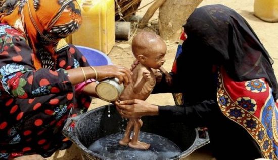 الفقر في اليمن.. سرطان الحوثي الذي ينهش في أجساد الضعفاء