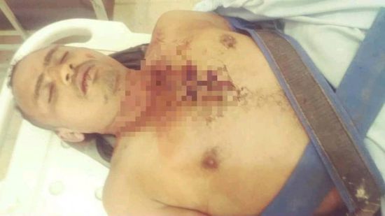 عصابة تقتل شابا لسرقة دراجته في تعز