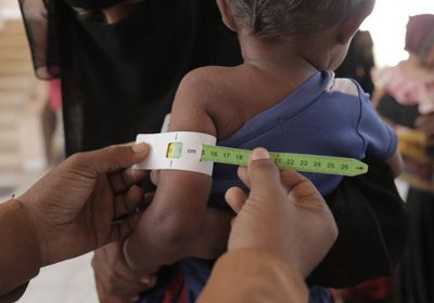 "يونيسف" تفحص 25 ألف طفل في حجة (صور)