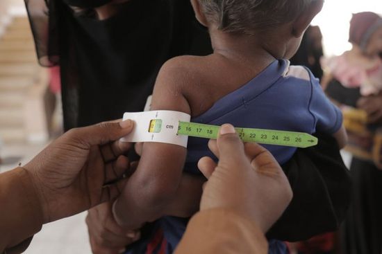 "يونيسف" تفحص 25 ألف طفل في حجة (صور)