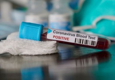 ارتفاع عدد الوفيات بفيروس كورونا في إيطاليا إلى 148