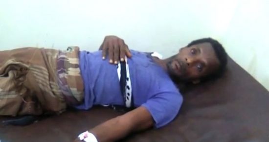 إصابة مواطنين في قصف لمليشيا الحوثي بحيس(فيديو)