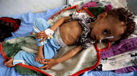  كيف أثرت الحرب الحوثية على صحة الأطفال العقلية؟