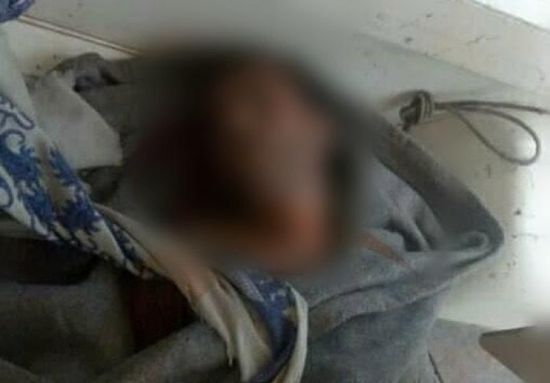 وفاة شخصين في حادثين منفصلين بلحج