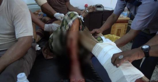 7 ضحايا في قصف حوثي على "إخوان ثابت" بالحديدة