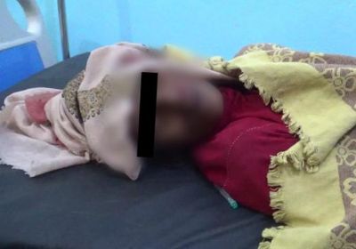 قناص حوثي يقتل سيدة في حيس