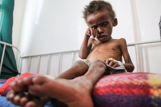 أزمة اليمن الغذائية.. كيف نهش الحوثيون في بطون المدنيين؟