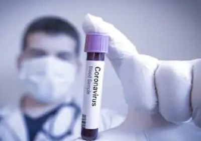 نتائج فحص امرأة "الكورونا " التي أثارت الرعب في صنعاء