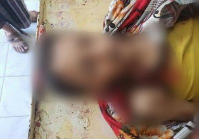 قناص حوثي يقتل طفلا ويجرح شقيقه في تعز (صور)  