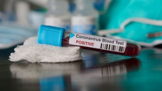 الجزائر تسجل أول حالة وفاة بفيروس كورونا بين الأطفال