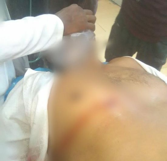 أطلق النار على ستيني وتوجه لأمن الحوطة