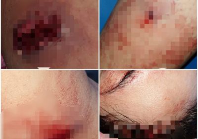 هجوم مسلح على منزل أستاذ جامعي بتعز