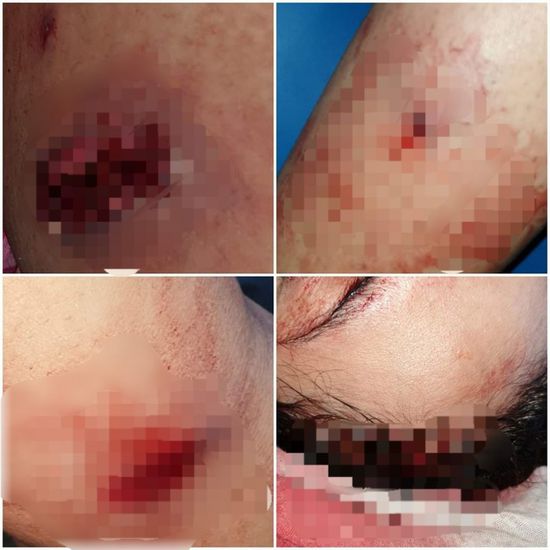 هجوم مسلح على منزل أستاذ جامعي بتعز