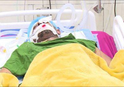 "المشتركة": استشهاد الصليحي جريمة حرب