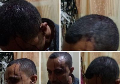 للمرة الثانية.. عصابة إخوانية تعتدي على الناشط شمسان بتعز