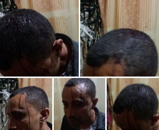 للمرة الثانية.. عصابة إخوانية تعتدي على الناشط شمسان بتعز