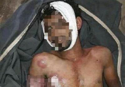 المليشيا عذبته بوحشية.. وفاة معتقل في سجن حوثي