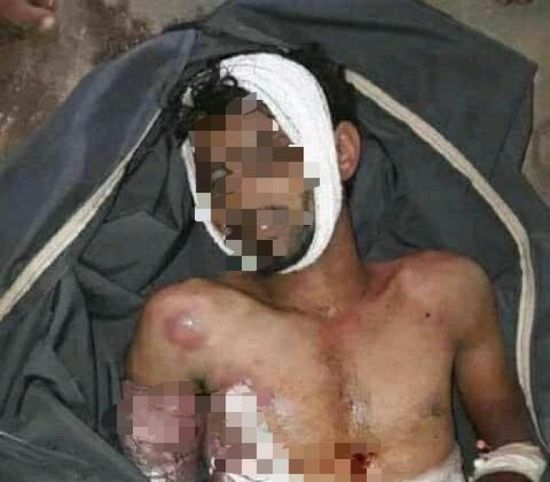 المليشيا عذبته بوحشية.. وفاة معتقل في سجن حوثي