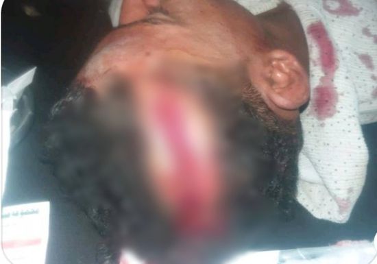 طقم إخواني يعتدي على مواطن بتعز