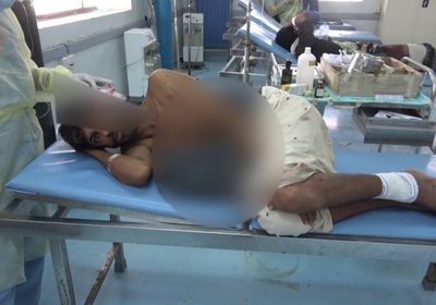 شاهد.. إصابة أربعيني بعبوة ناسفة حوثية في الجاح