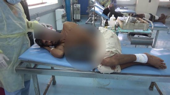 شاهد.. إصابة أربعيني بعبوة ناسفة حوثية في الجاح