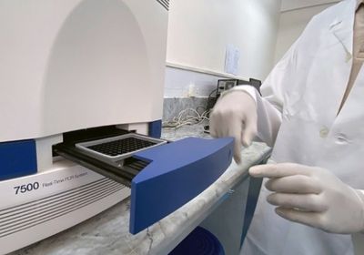 الصحة العالمية تكافح كورونا باليمن بجهاز PCR