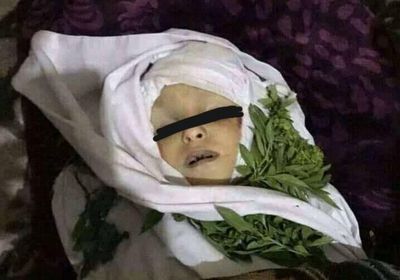 طقم عسكري حوثي يدهس طفلا في إب