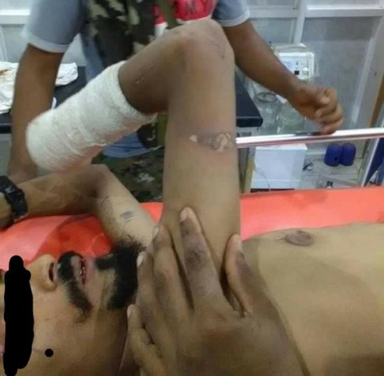 ضبط متهم أصاب 4 بقنبلة يدوية في البريقة