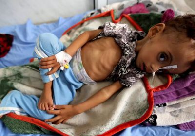  كورونا و"المأساة الفظيعة".. أطفالٌ أنهكتهم الحرب الحوثية