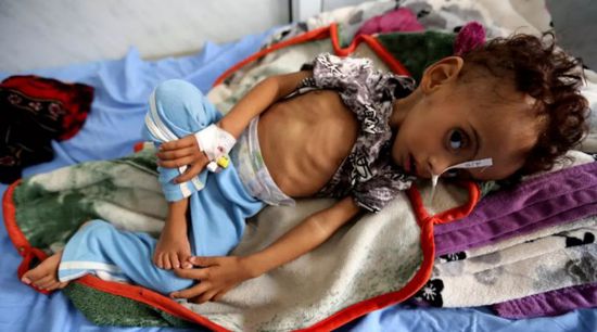  كورونا و"المأساة الفظيعة".. أطفالٌ أنهكتهم الحرب الحوثية