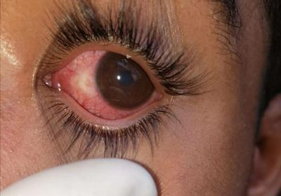 "المسدسات الخرز" شر يخطف أبصار الأطفال  