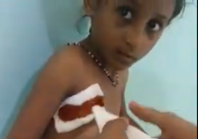 بقنبلة حوثية.. استشهاد طفل وإصابة شقيقته في حيس (فيديو)
