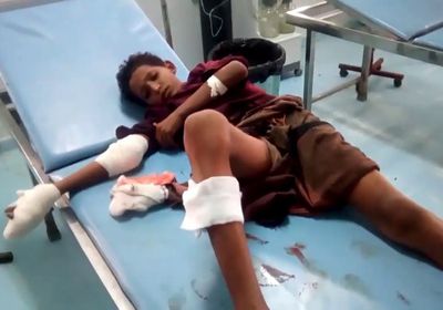 إصابة طفل في قصف حوثي لمنطقة المُتينة