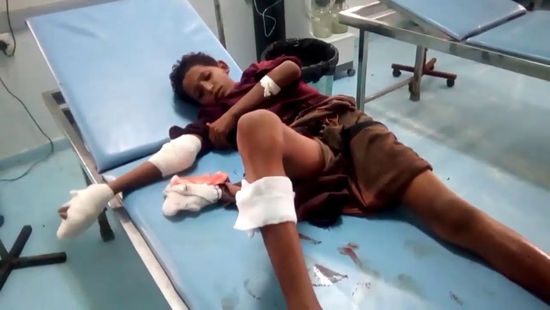 إصابة طفل في قصف حوثي لمنطقة المُتينة
