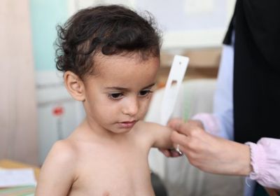 الغذاء العالمي: سوء التغذية يؤثر على مليوني طفل باليمن