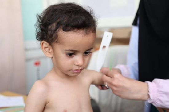الغذاء العالمي: سوء التغذية يؤثر على مليوني طفل باليمن