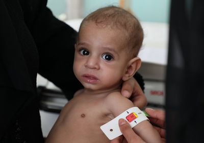 "الغذاء العالمي" يحذر من تفاقم سوء التغذية باليمن