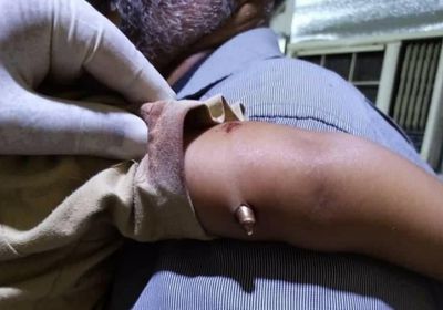 عيار ناري يصيب طفلًا في الريدة الشرقية