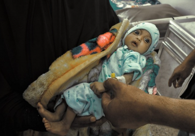 الصحة العالمية: فحص 102 ألف طفل يعانون سوء التغذية في عام