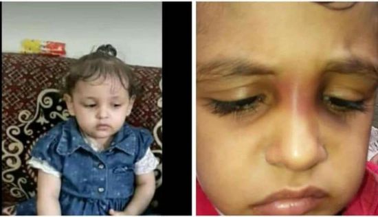 تزوجها لترعى طفلته فعذبتها حتى الموت