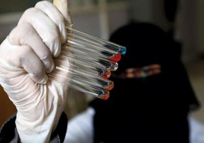 تعز تتسلم محاليل لفحص 750 عينة كورونا