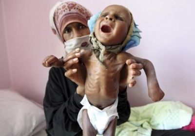 المشروعات الأممية في اليمن.. جهود دولية لسد رمق الجوعى