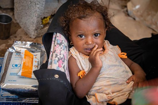 "الغذاء العالمي": مليونا طفل يعانون من سوء التغذية