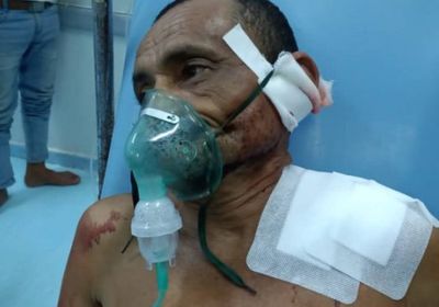 قناص حوثي يصيب مواطنًا في حيس