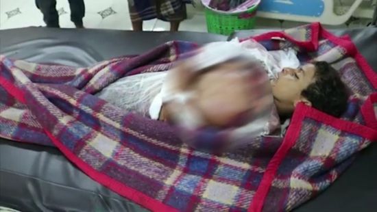 بدم بارد.. قناص حوثي يقتل طفلًا شرق الحديدة (فيديو)