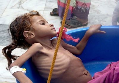 كورونا وأطفال اليمن.. جائحةٌ ضاعفت الأوجاع