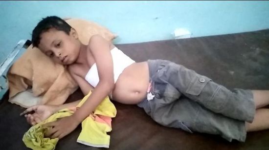 مدفعية الحوثي تقصف حيس وتصيب طفلًا