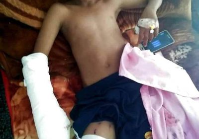 إصابة طفل بمقذوف حوثي شمال الضالع