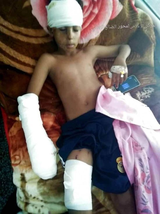 إصابة طفل بمقذوف حوثي شمال الضالع